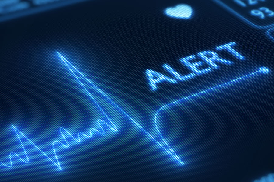 Nega-scan Monitor automated Alerts